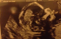 Anyone ttc baby #2 continued?