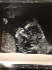 August 2016 (3) - scans fast approaching, teeny tiny bumps appearing, and sickness easing....we hope!