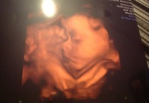 March 2016 Babies!! New Year, New Thread - #8