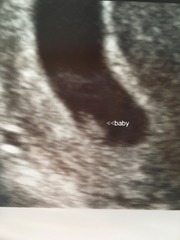 Anyone ttc baby #2 continued?