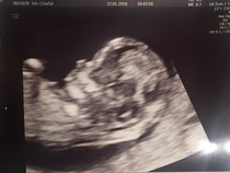 August 2016 (3) - scans fast approaching, teeny tiny bumps appearing, and sickness easing....we hope!