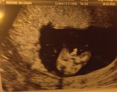 Anyone ttc baby #2 continued?