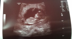 August 2016 (3) - scans fast approaching, teeny tiny bumps appearing, and sickness easing....we hope!
