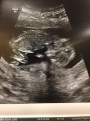 August 2016 (3) - scans fast approaching, teeny tiny bumps appearing, and sickness easing....we hope!