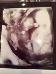 August 2016-with Berries turning into Beans and a whole lotta fun ahead!