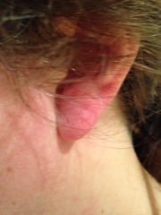 Red marks appearing on body for apparently no reason?