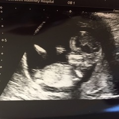 August 2016 (3) - scans fast approaching, teeny tiny bumps appearing, and sickness easing....we hope!