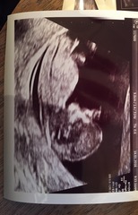 August 2016-with Berries turning into Beans and a whole lotta fun ahead!