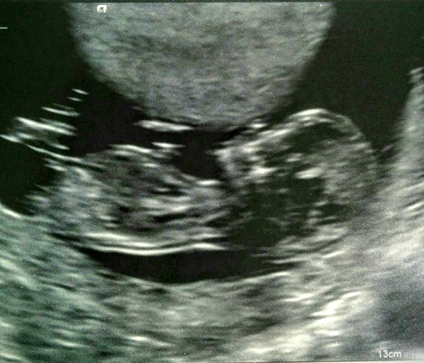 I'm nauseous and bored. Guess the gender of my baby?