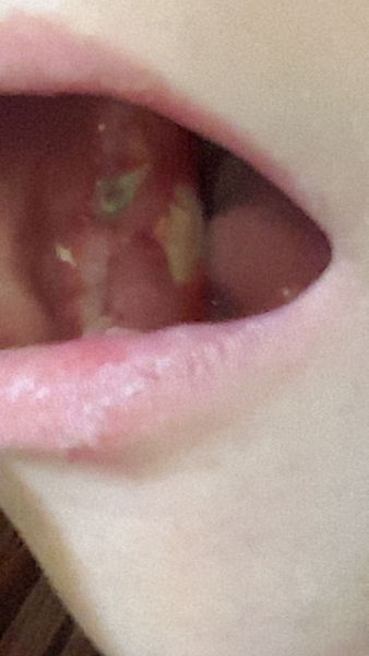 A dental question please not very nice pic included sorry