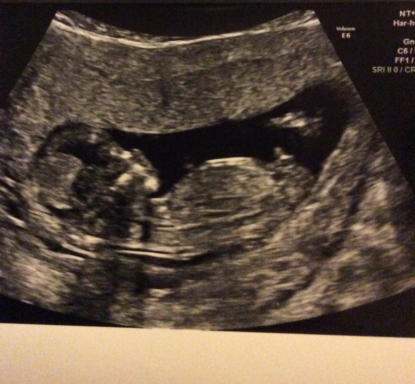 thread #2 - TTC#1 Grads, sick bags at the ready!