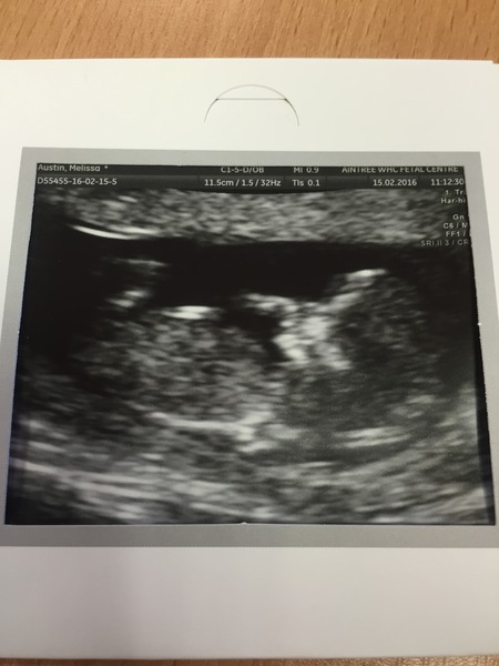 Gender guess??