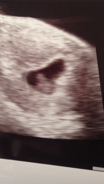 Reassurance scan