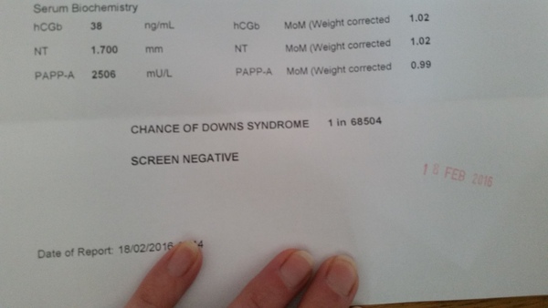 August 2016 (3) - scans fast approaching, teeny tiny bumps appearing, and sickness easing....we hope!