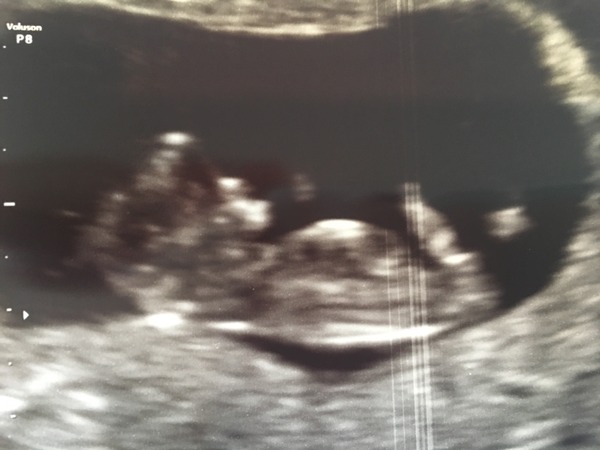 thread #2 - TTC#1 Grads, sick bags at the ready!