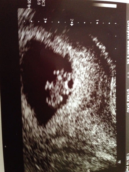 October 2016 bus #2 - getting our bfp's