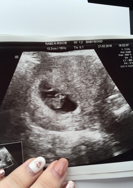 October 2016 bus #2 - getting our bfp's