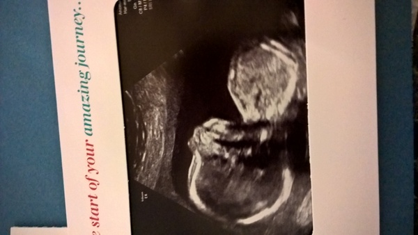 June 2016 #6, Blue? Pink? Yellow? Where did the first 20 weeks go?