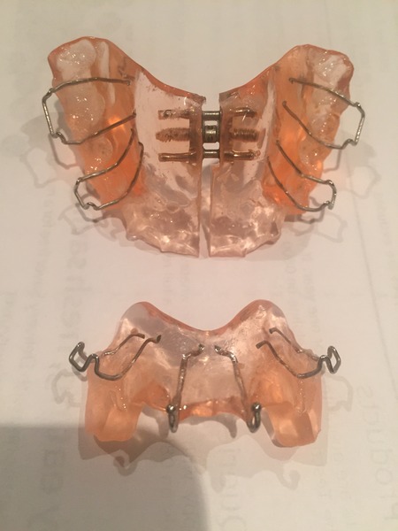 Twin Block Braces - Any Advice?