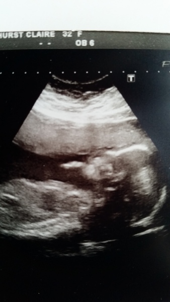 June 2016 #6, Blue? Pink? Yellow? Where did the first 20 weeks go?