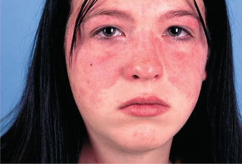 Help me fix my red, blotchy skin
