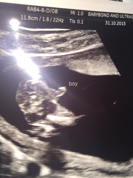 Baby just gender scan girl but looks like boy