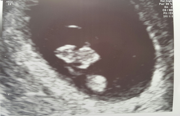 Thread #3 - TTC#1 Grads thread. No TMI is too much, no question too stupid!