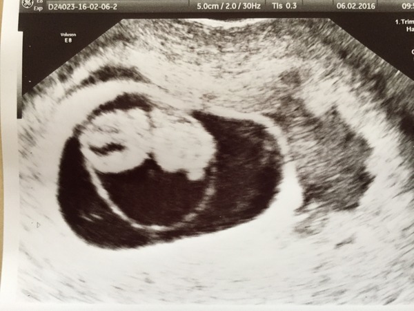 September 2016 (Thread 2) Booking in and 12 weeks scans soon!