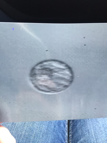 Anyone starting IVF? Join me (5)