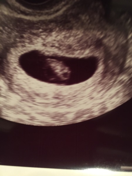 September 2016 (Thread 2) Booking in and 12 weeks scans soon!