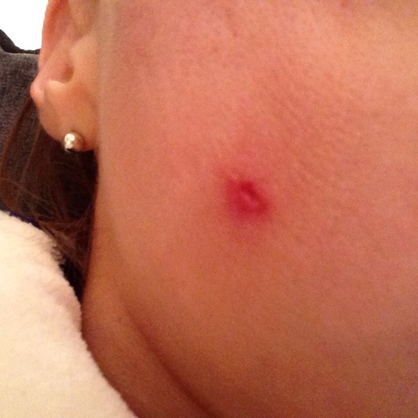Has anyone else experienced this skin problem or am I totally unique?
