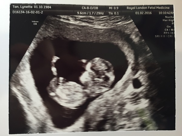 August 2016 (3) - scans fast approaching, teeny tiny bumps appearing, and sickness easing....we hope!