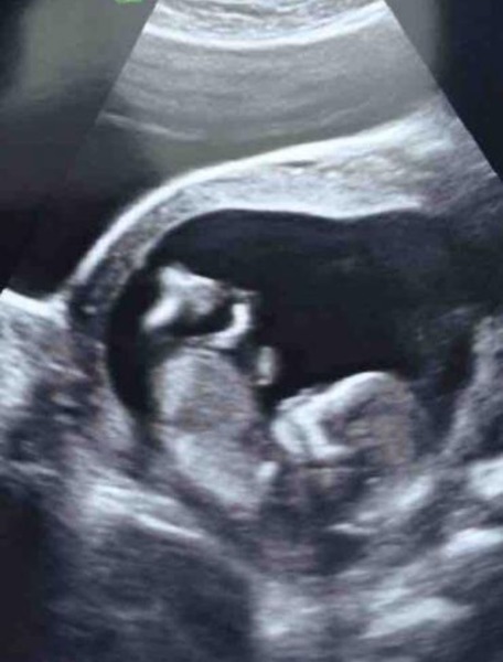 Just for fun, 14wks, Boy or girl?!