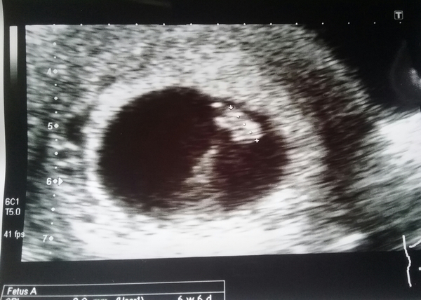 Reassurance scan