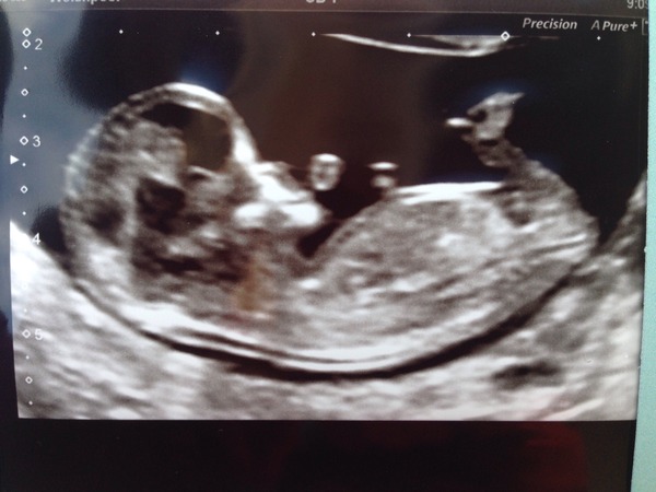 thread #2 - TTC#1 Grads, sick bags at the ready!