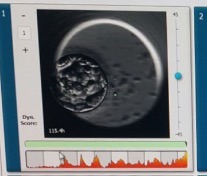 Forty and over trying for a first baby - join us here