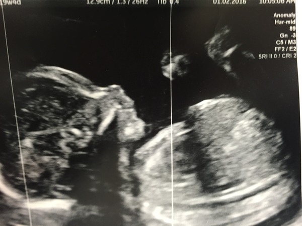 June 2016 #6, Blue? Pink? Yellow? Where did the first 20 weeks go?