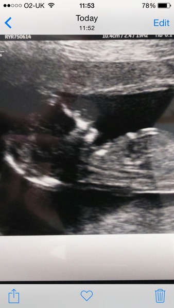 Staying posifrickentive- Thread 8 for ladies after mc