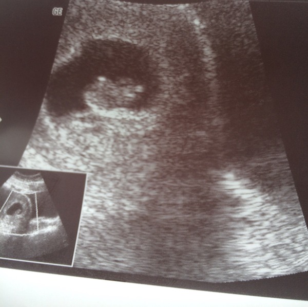 Thread #3 - TTC#1 Grads thread. No TMI is too much, no question too stupid!