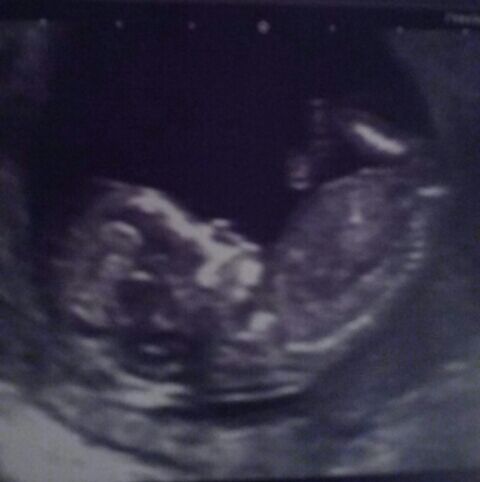 12 week scan - boy or girl??