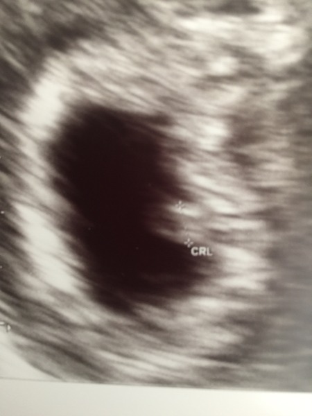 October 2016 bus #2 - getting our bfp's