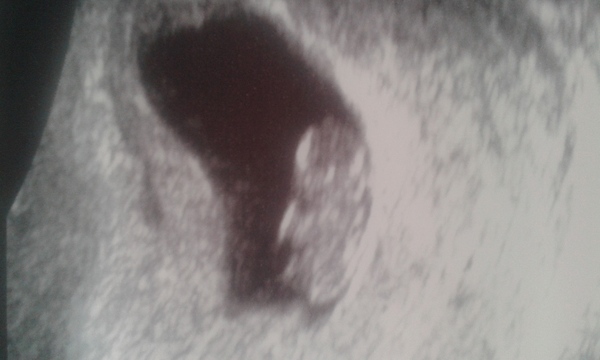 September 2016 (Thread 2) Booking in and 12 weeks scans soon!