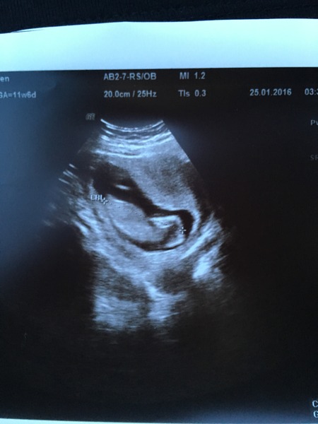 Is this a normal scan picture?
