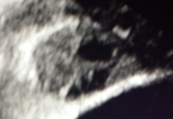 Thread 10 ttc#1 The one where we're all really bored of hormones,  the tww and cervical mucus or Why is my eggo not preggo!?