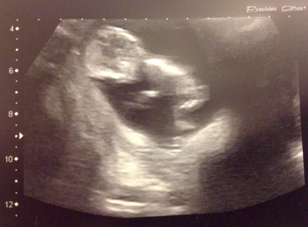 thread #2 - TTC#1 Grads, sick bags at the ready!