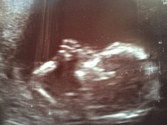 August 2016 (3) - scans fast approaching, teeny tiny bumps appearing, and sickness easing....we hope!