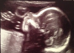 June 2016 #7 - We're still waiting for the second trimester "bloom" but healthy babies and stronger kicks all around!!