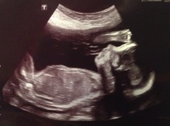 June 2016 #7 - We're still waiting for the second trimester "bloom" but healthy babies and stronger kicks all around!!