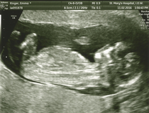August 2016 (3) - scans fast approaching, teeny tiny bumps appearing, and sickness easing....we hope!