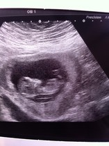 Baby just gender scan girl but looks like boy